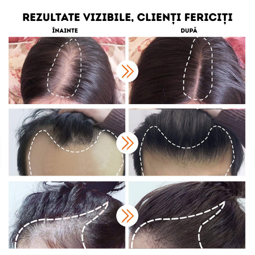 Serum Anti-Cădere Pro Growth cu BIOTINĂ